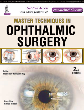 master-techniques-in-ophthalmic-surgery