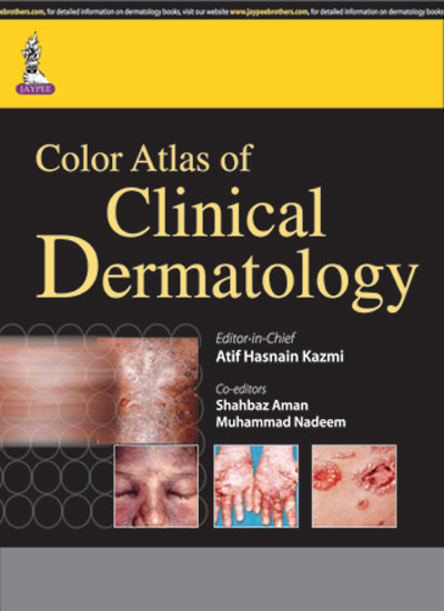 color-atlas-of-clinical-dermatology