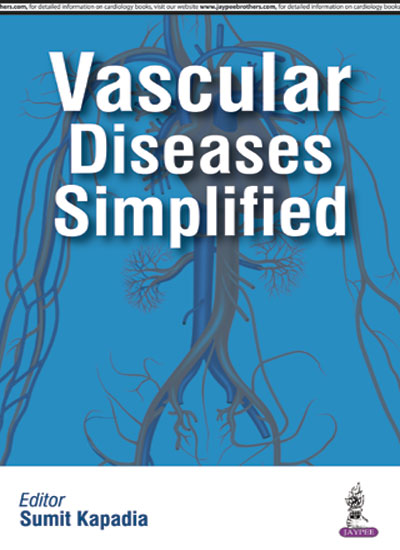 vascular-diseases-simplified
