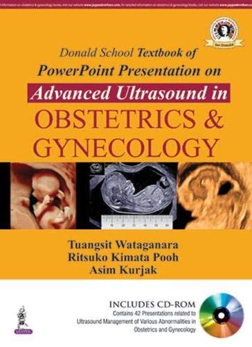 donald-school-textbook-of-powerpoint-presentation-on-advanced-ultrasound-in-obs-gyn-with-dvd-rom