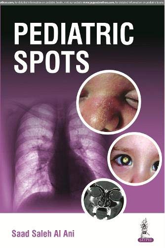 pediatric-spots