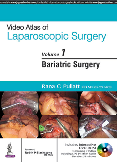 video-atlas-of-laparoscopic-surgery-vol1-bariatric-surgery-with-dvd-rom
