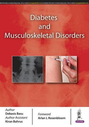 diabetes-and-musculoskeletal-disorders