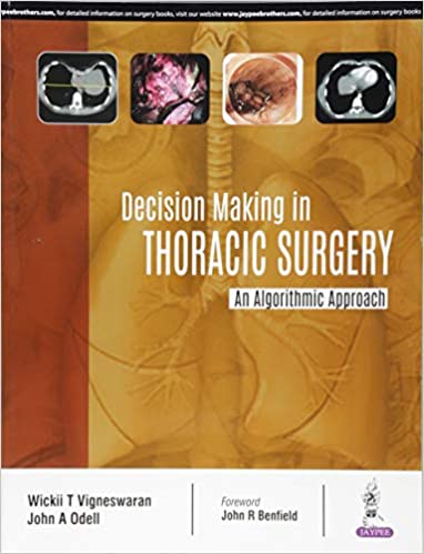 decision-making-in-thoracic-surgery-an-algorithmic-approach