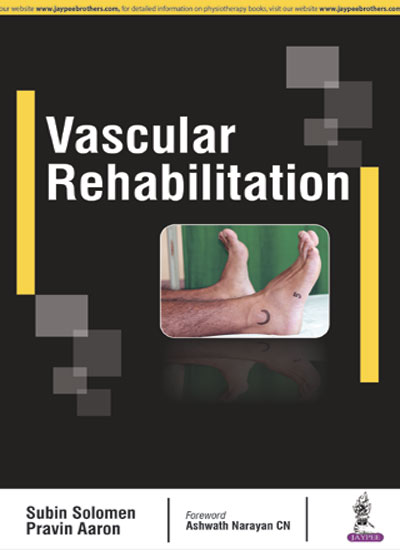 vascular-rehabilitation