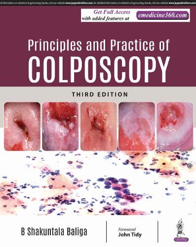 principles-and-practice-of-colposcopy