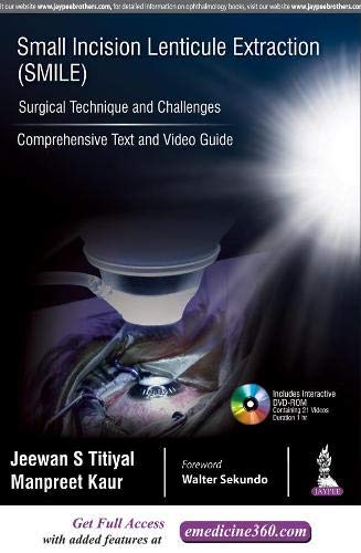 small-incision-lenticule-extraction-smile-surgical-technique-and-challengescomprehensive-text