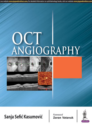 oct-angiography