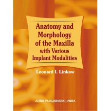 anatomy-and-morphology-of-the-maxilla-with-various-implant-modalities
