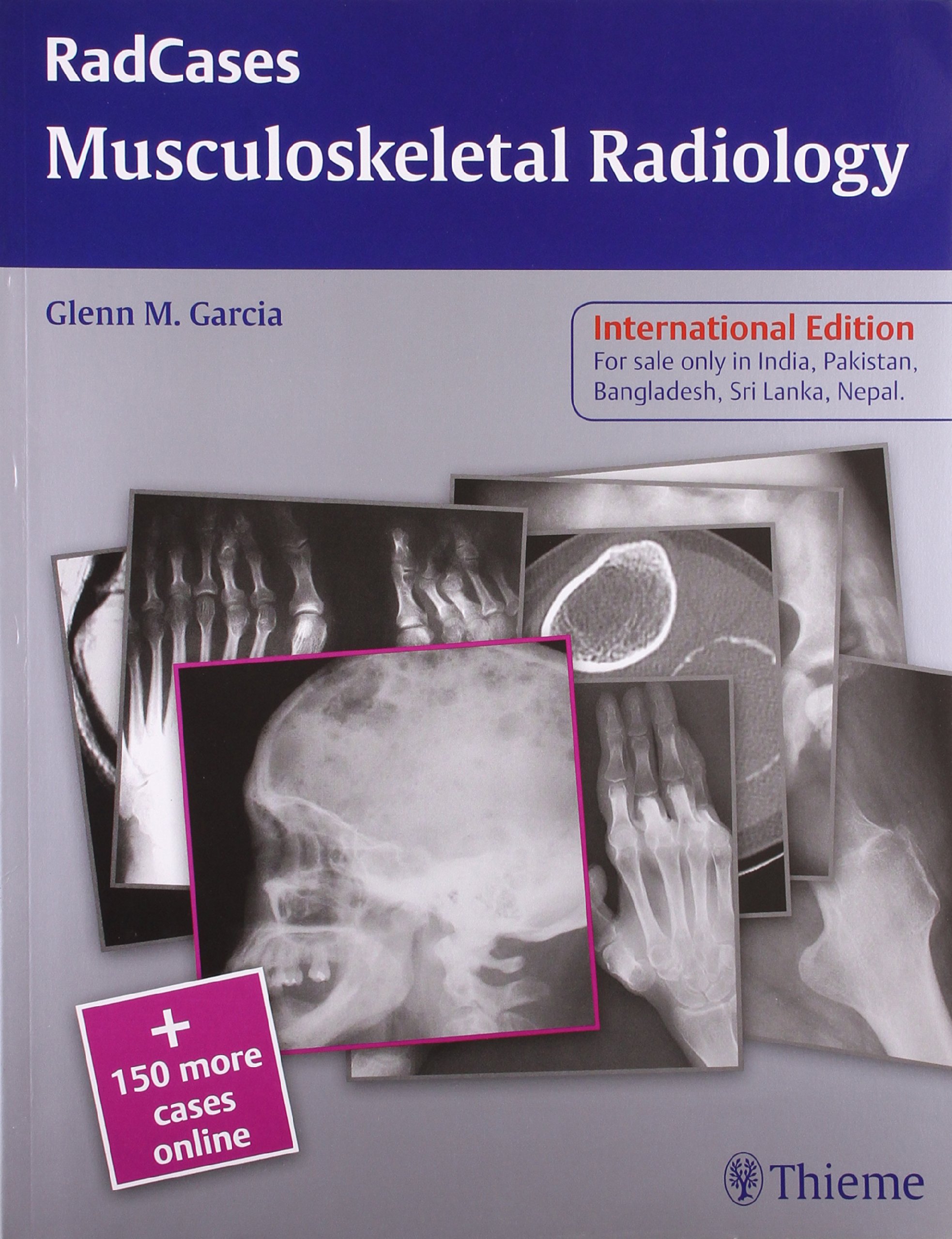 musculoskeletal-radiology-1e-radcases-indian-reprint
