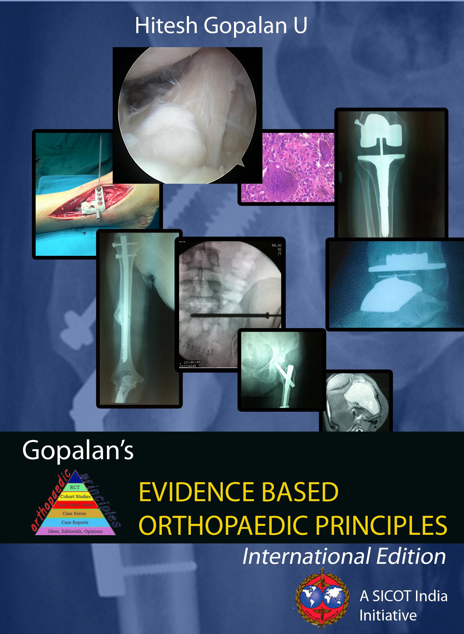 gopalans-evidence-based-orthopaedic-principles