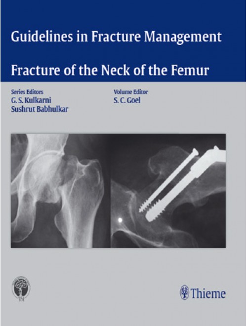 guidelines-in-fracture-management-fracture-of-the-neck-of-the-femur