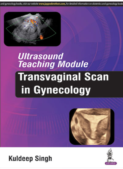 ultrasound-teaching-moduletransvaginal-scan-in-gynecology