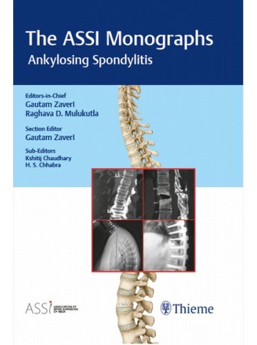 the-assi-monographs-ankylosing-spondylitis-1e