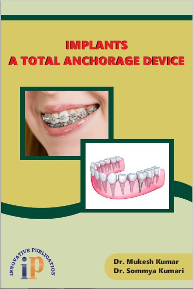 implants-a-total-anchorage-device
