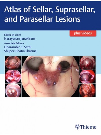 atlas-of-sellar-suprasellar-and-parasellar-lesions