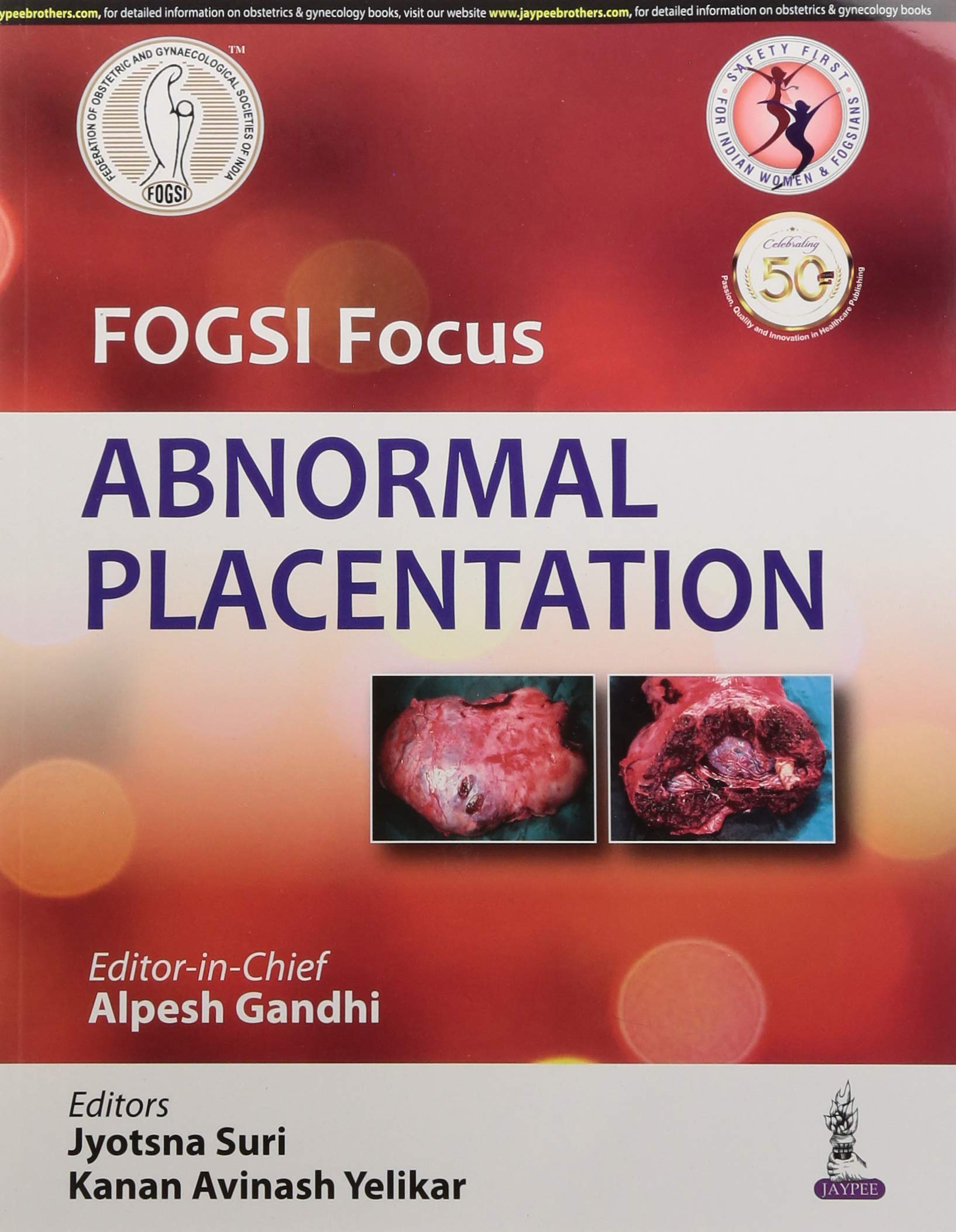 fogsi-focus-abnormal-placentation