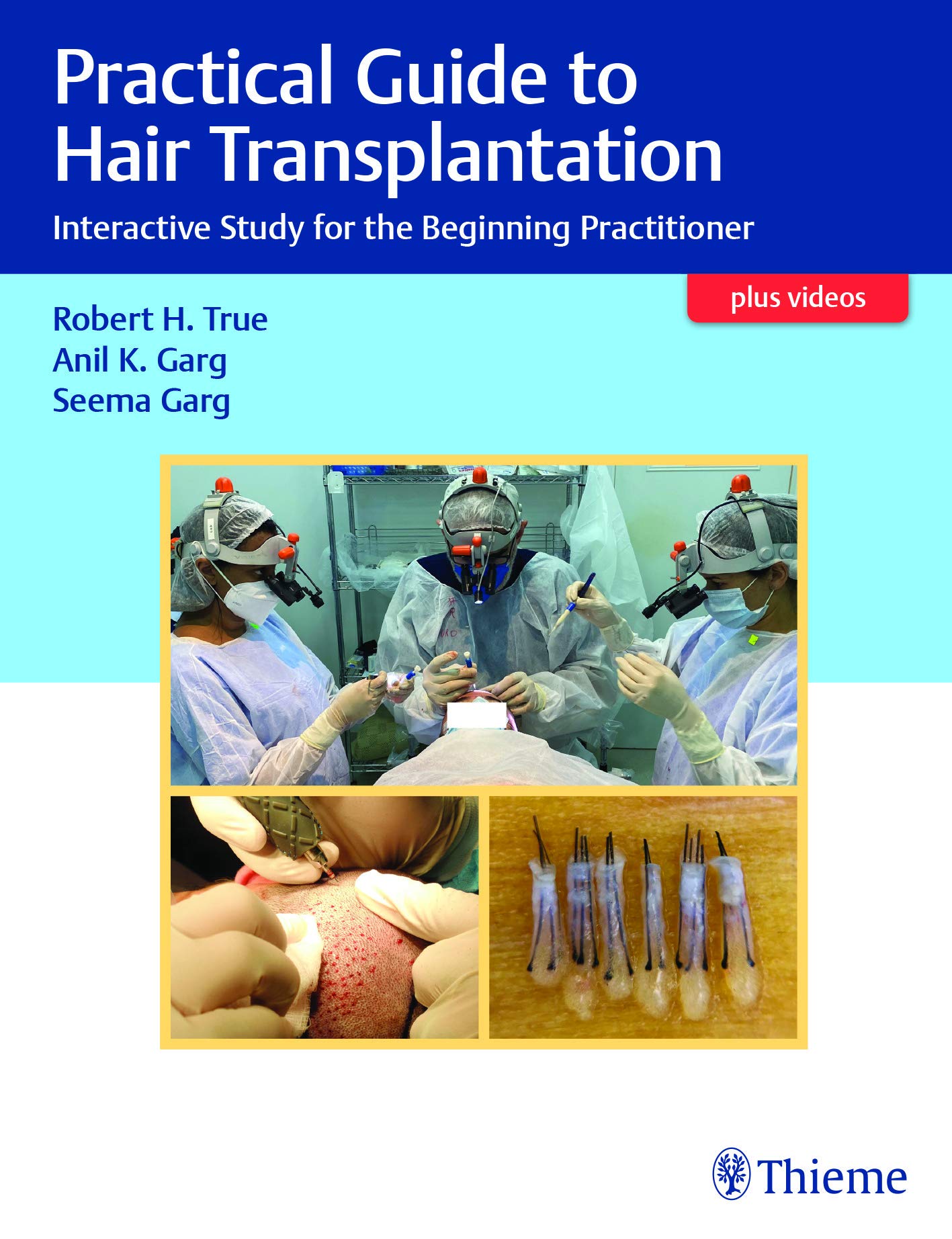 practical-guide-to-hair-transplantation